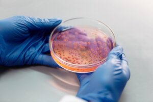 Imagen del artículo de Radio Isla 1320: Secretario de Salud desmiente que haya un caso confirmado de bacteria come carne en Puerto Rico